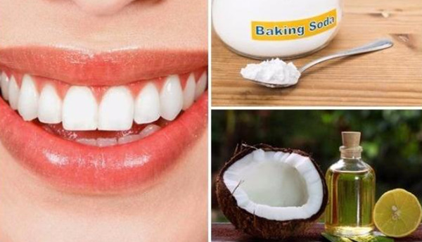 15 Cách làm trắng răng tại nhà an toàn cực hiệu quả