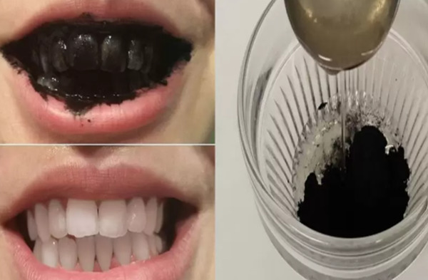 15 Cách làm trắng răng tại nhà an toàn cực hiệu quả
