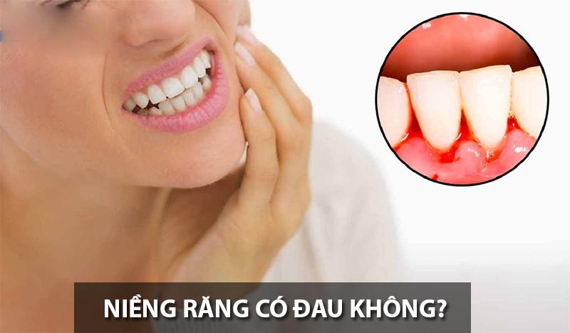 Tẩy trắng răng có hại gì với sức khỏe và những đối tượng không nên tẩy