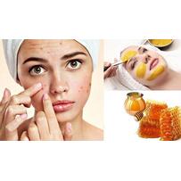 15 Cách trị mụn bọc sưng đỏ tại nhà bằng phương pháp tự nhiên hiệu quả