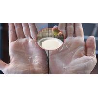 Ám ảnh Tết: lo rửa bát chén, da bong cả tảng, hãy trị dứt điểm nhờ công thức này