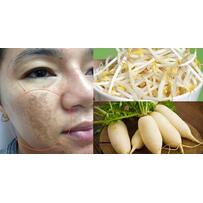 Dùng củ cải và giá đỗ rồi làm theo công thức này, nám nặng đến đâu cũng bị đánh bay