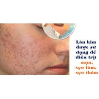 Liệu trình lăn kim trị mụn bao nhiêu lần thì da đẹp?