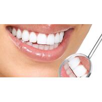 Nha sĩ giải đáp "Giá trồng răng sứ bao nhiêu tiền?"