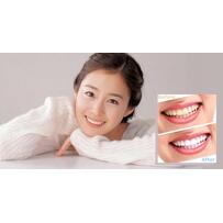 Tẩy trắng răng và những lưu ý cần biết về làm trắng răng tại nhà