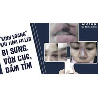 Tiêm filler bị vón cục, sưng đau, bầm tím - vì đâu nên nỗi?