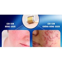 Vì sao sau khi lăn kim bị nổi mụn, ngứa và bong da?