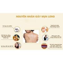 13 cách trị mụn lưng từ nguyên liệu tự nhiên an toàn và hiệu quả nhất